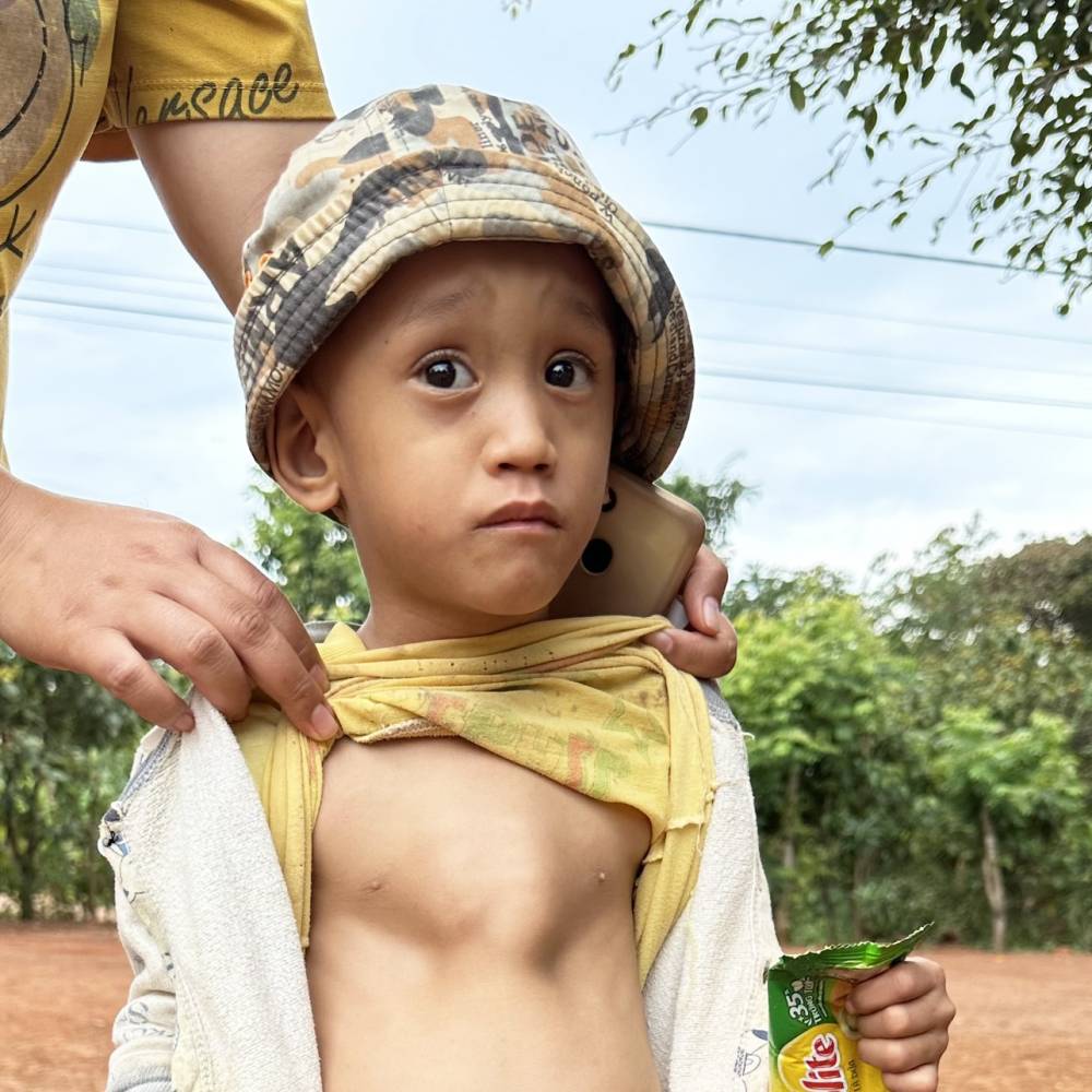 Y Chươn Kễn